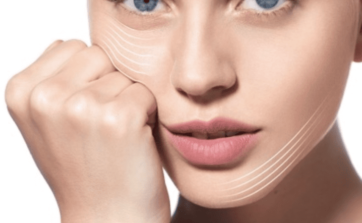 Top 5 Benefits of Profhilo Treatments