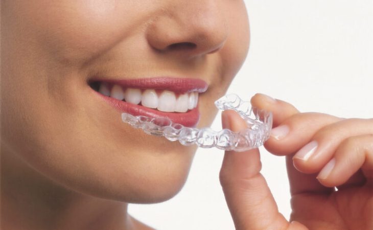 Get the Confident Lifelong Smile you Deserve with Invisalign at Discovery Dental