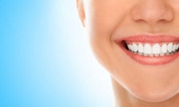 Invisalign: Transforming Smiles at Pickens Family Dentistry