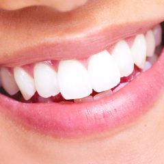 The Truth About MySmile Teeth Whitening Strips: How Effective Are They?