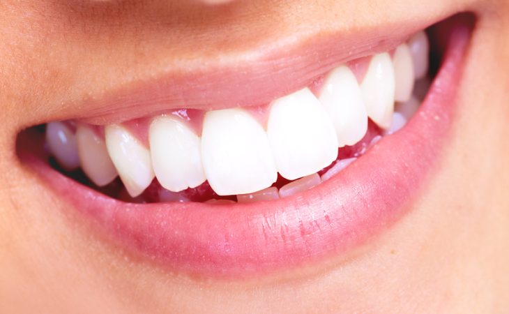 The Truth About MySmile Teeth Whitening Strips: How Effective Are They?