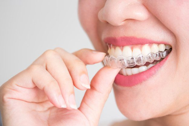 East Mahogany Dental in Calgary: Your Expert Invisalign Dentist