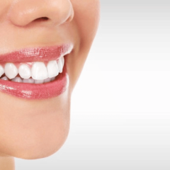 Top 5 Reasons to Choose Smiles by Payet for Your Dental Needs