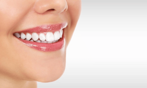 Top 5 Reasons to Choose Smiles by Payet for Your Dental Needs