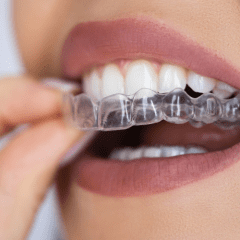 Why Invisalign Is a Game Changer for Adults Seeking a Perfect Smile